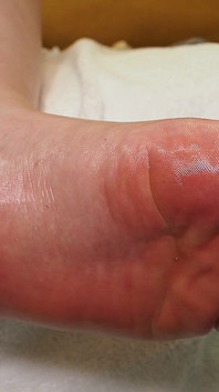 Look in Silence: My Foot and Massage