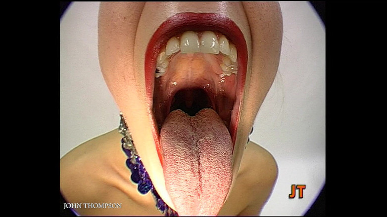 GGG John Thompson: 존 톰슨 래스 미치 슐루켄 1부