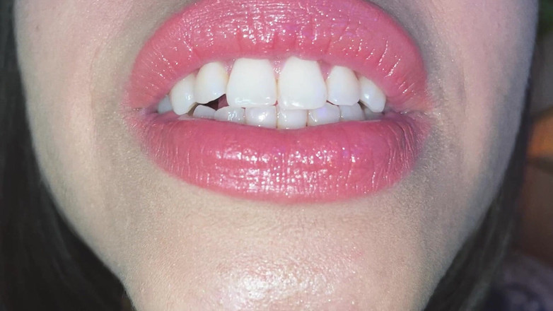 CoralTrip: भूखा