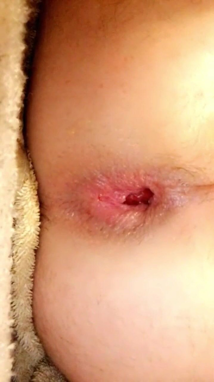 Bottomfemboi: Masukin pantatku pakai butt plug. Yummy