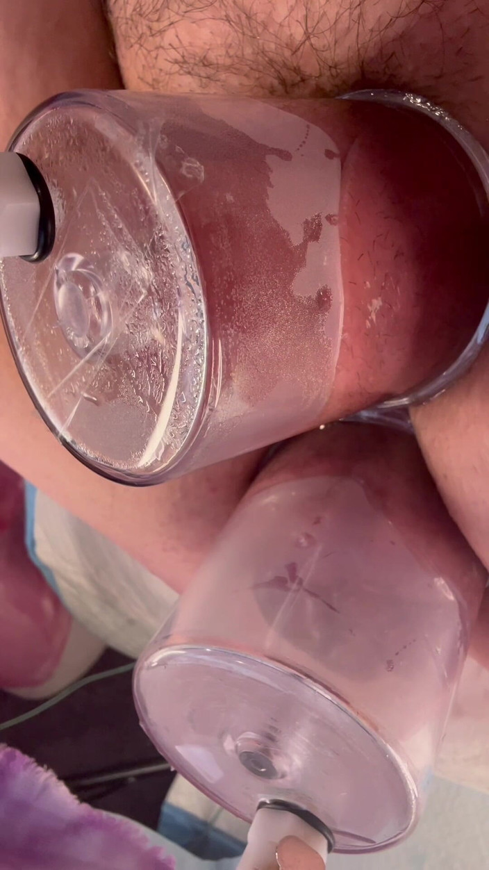 Kinky Midwest Meadows: Duplo bombeamento a vácuo