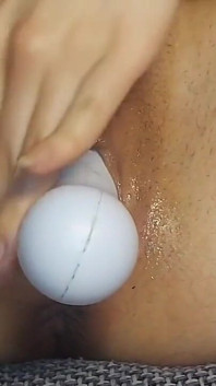 And Breast Tear
