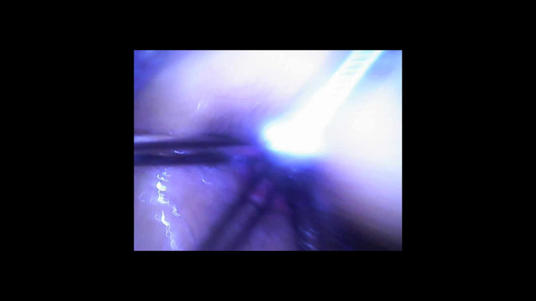 Fetish Bear Productions: Speculum &amp; Microcamera voor Lady Soniac