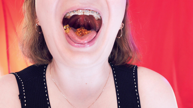 Arya Grander: Asmr Makan Beruang Jelly Dengan Pendakap Gigi oleh Arya Grander