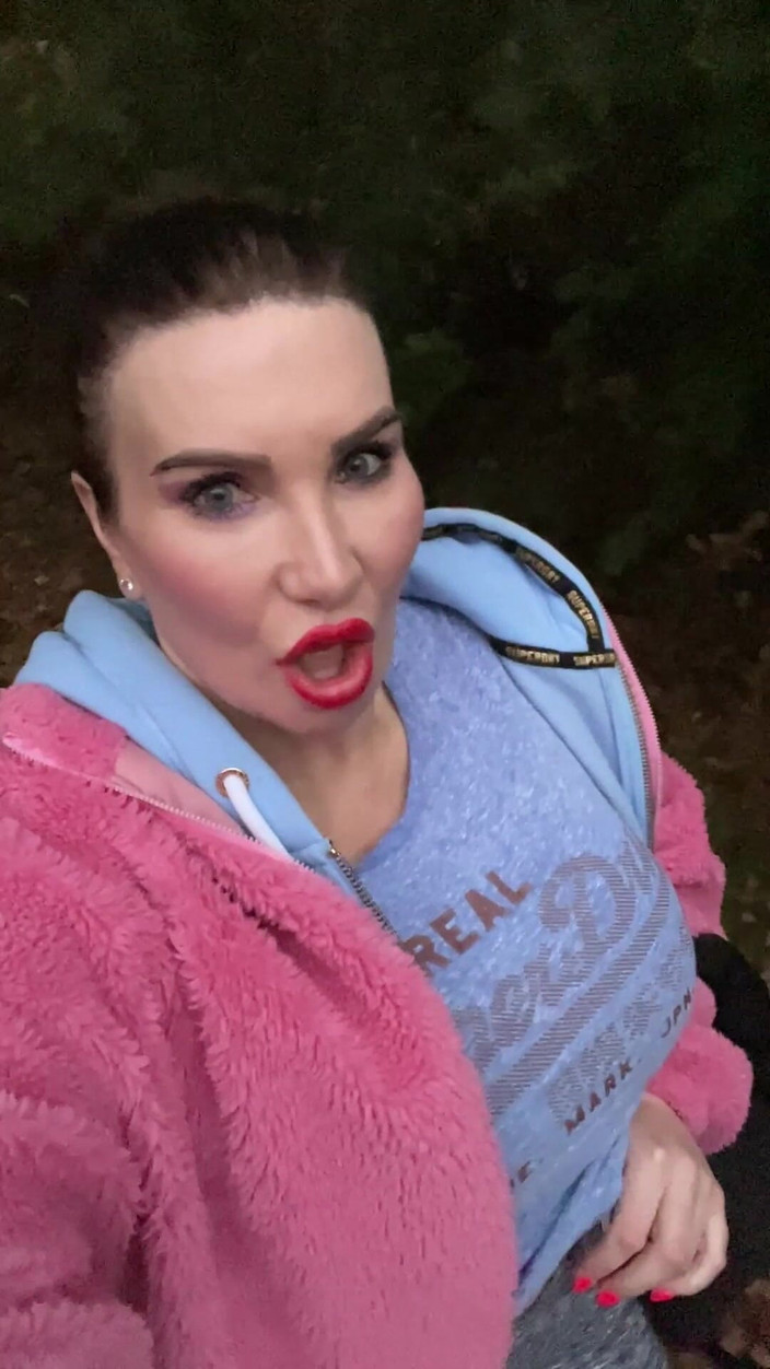 Sophie James: 公園の猫でおしっこ