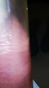 It's Starting with a Finger...