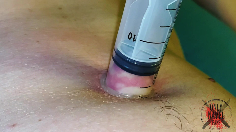 Navel fans: Jocuri cu stomacul