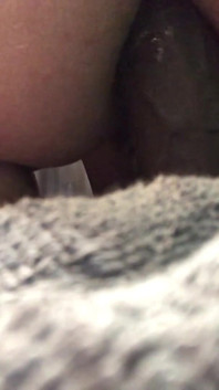 Thick Anal