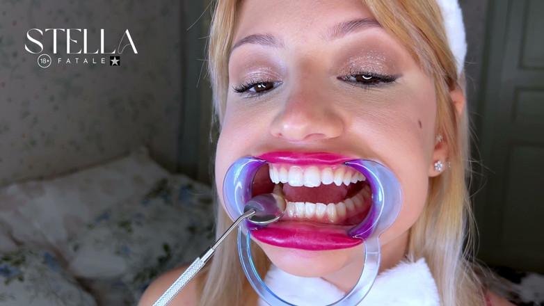 Stellafatale: Mouth Retractor Teeth Examination