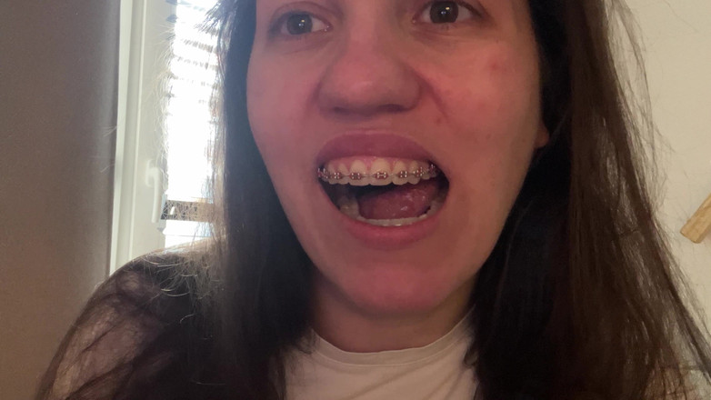 NicoleRay: Menjilat pendakap gigi dengan lidah anda