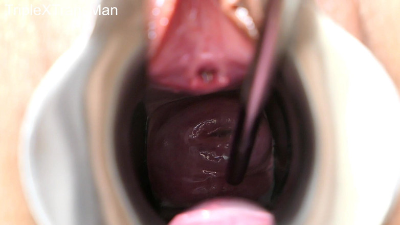 TripleXTransMan: मेरी गर्भाशय ग्रीवा में घुसना!