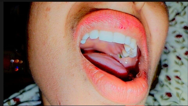 Ankita277: 쪼이는 보지 힌디어 오디오로 소녀와 섹스하는 Deshi Villege 대학 Gril 바이러스 성 비디오 섹스