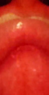 My Lips