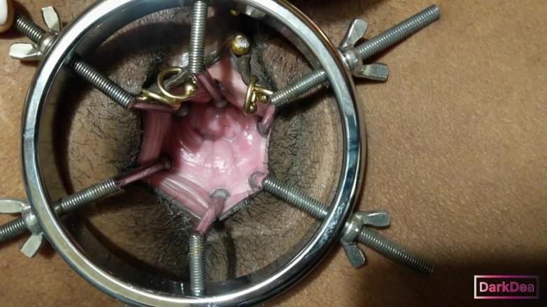 Dark Dea: The kinky slut queen Dark Dea in (extreme cow speculum with...