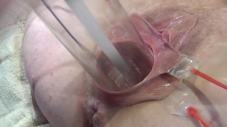 deep keely: 10 Weit Gespreizte Muschi Nahaufnahme Fickt Mit Lampe 1000 Watt