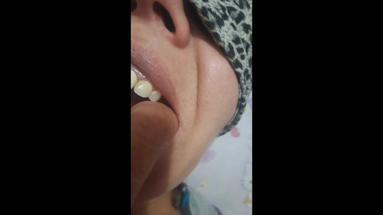 Paultramp: Укус пальця