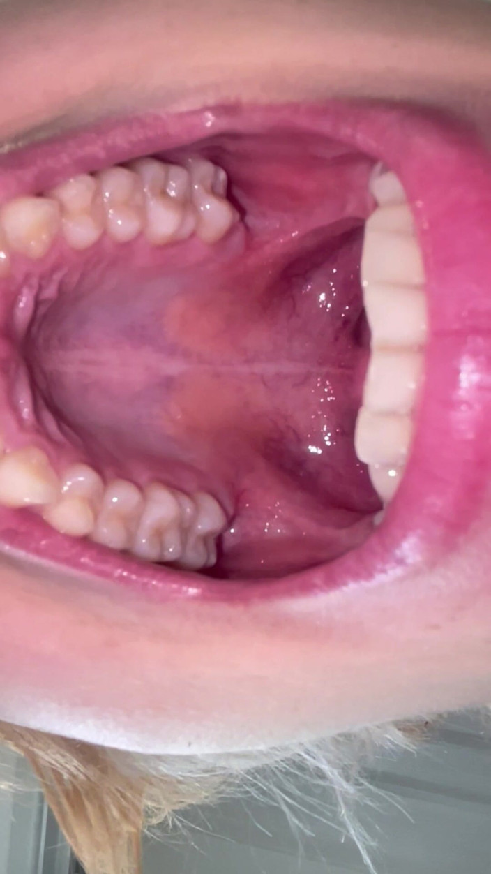 Glitterqueen1999: Mouth Tour Flash on Deep Inside My Mouth