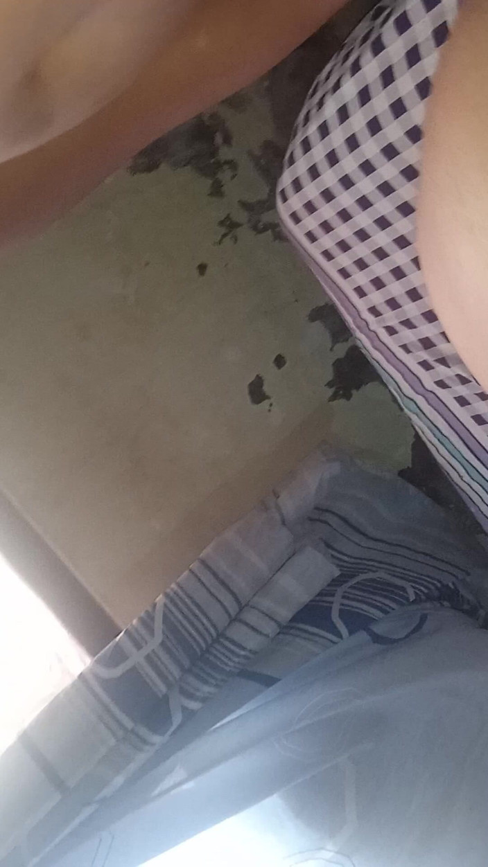 Eatrella j: 引爆奇波拉