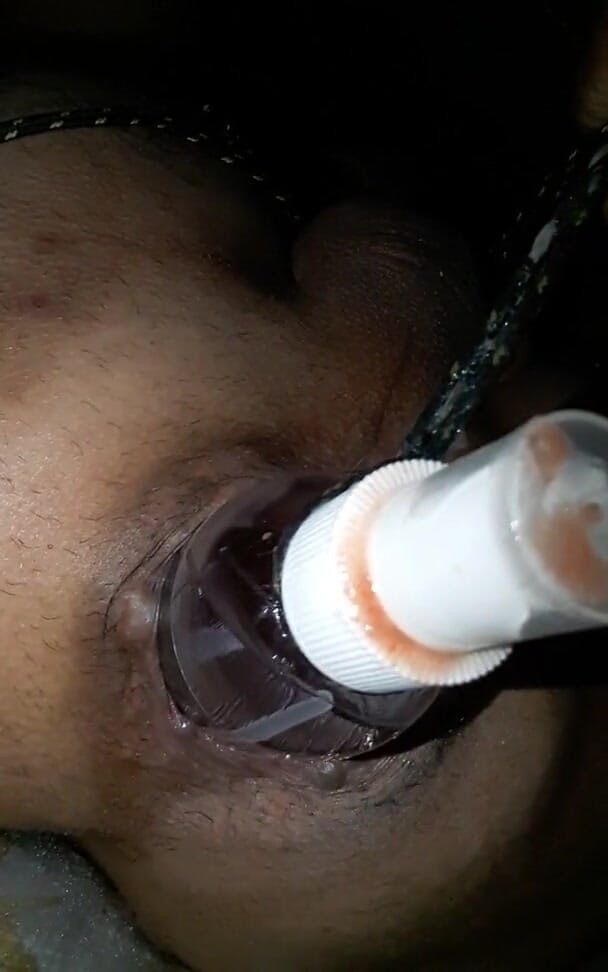 Renoreis: From the depths of my tunnel so I was looking...