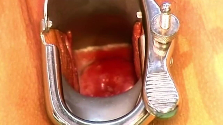 Bitch hunter: Mature Babe's Pussy Stretched Wide with Speculum and Devoured