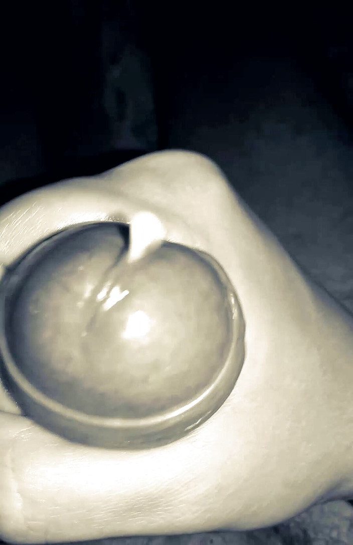 CACOFLORIPA: लगभग दूध नहीं था