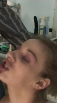 The blonde nurse masturbates with a big black phallus in front of the patient on crutches