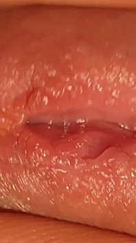How to Widen a Glans Hole to the Extreme.