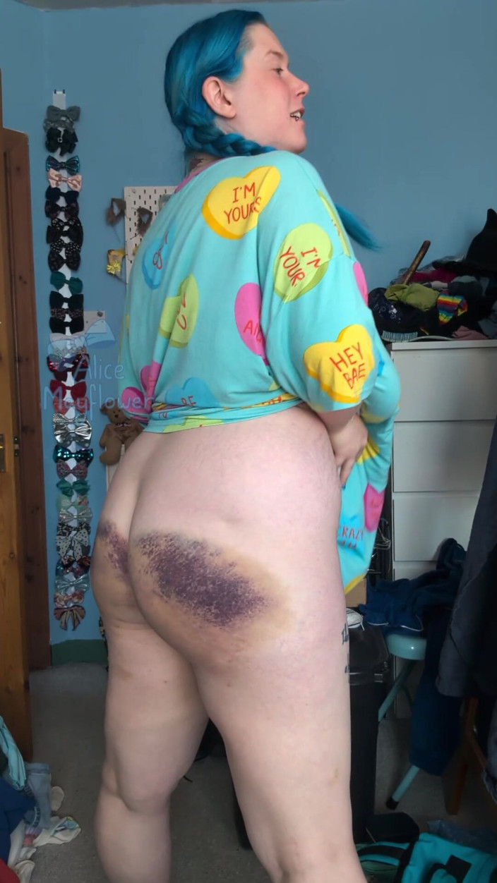 Alice_Mayflower_Scottish: Very Bruised Ass Aftercare - Solo Girl