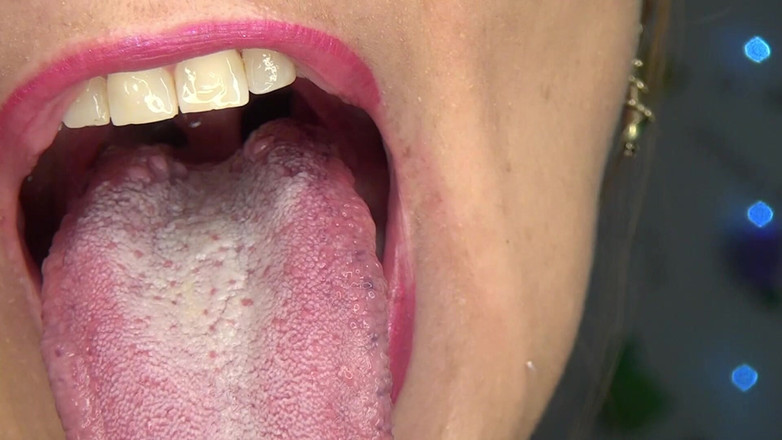 Angel eyes studio: 거울 앞에서 목젖, 혀, 입을 만지작거리고 있어요