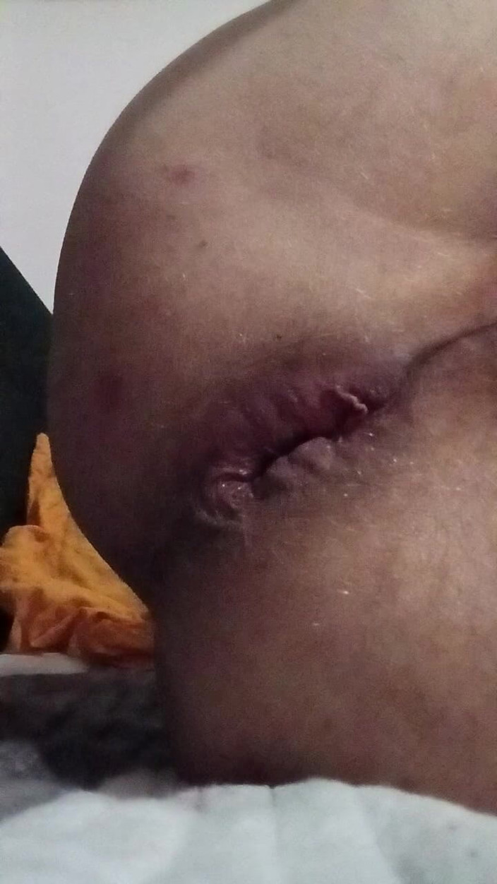 Haus86: Porn Ass