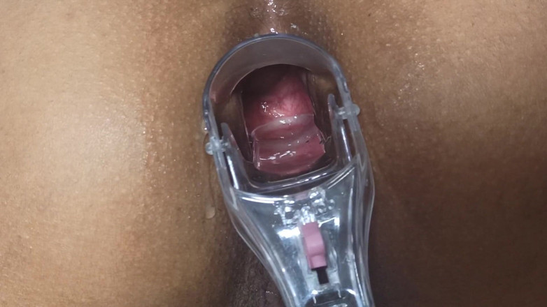 Xamy_97: Speculum in my anus part 1