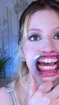 Teeth Fetish Extreme Close-up Dental Examination
