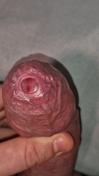 Close up on Phimosis Large Cock, so Hot!