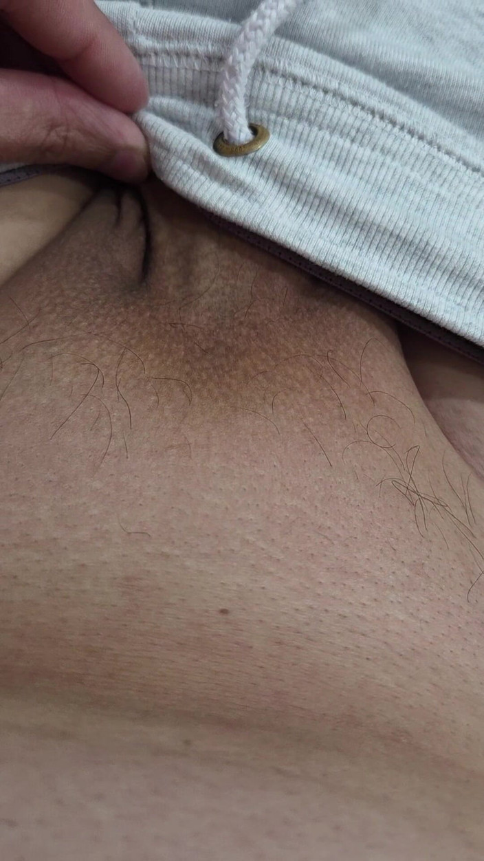 Lkdick8: Les poils sur mon pénis - Épilation à Led