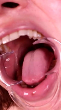 Inside my mouth: ginary