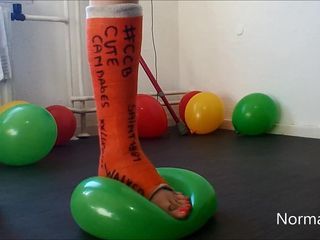 Just Elocin: Popping Balloons in a Leg Cast