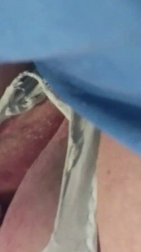 Oops They Tore!