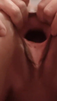 Gapping Pussy Very Closeup Cunt Open Stretching Dilatation