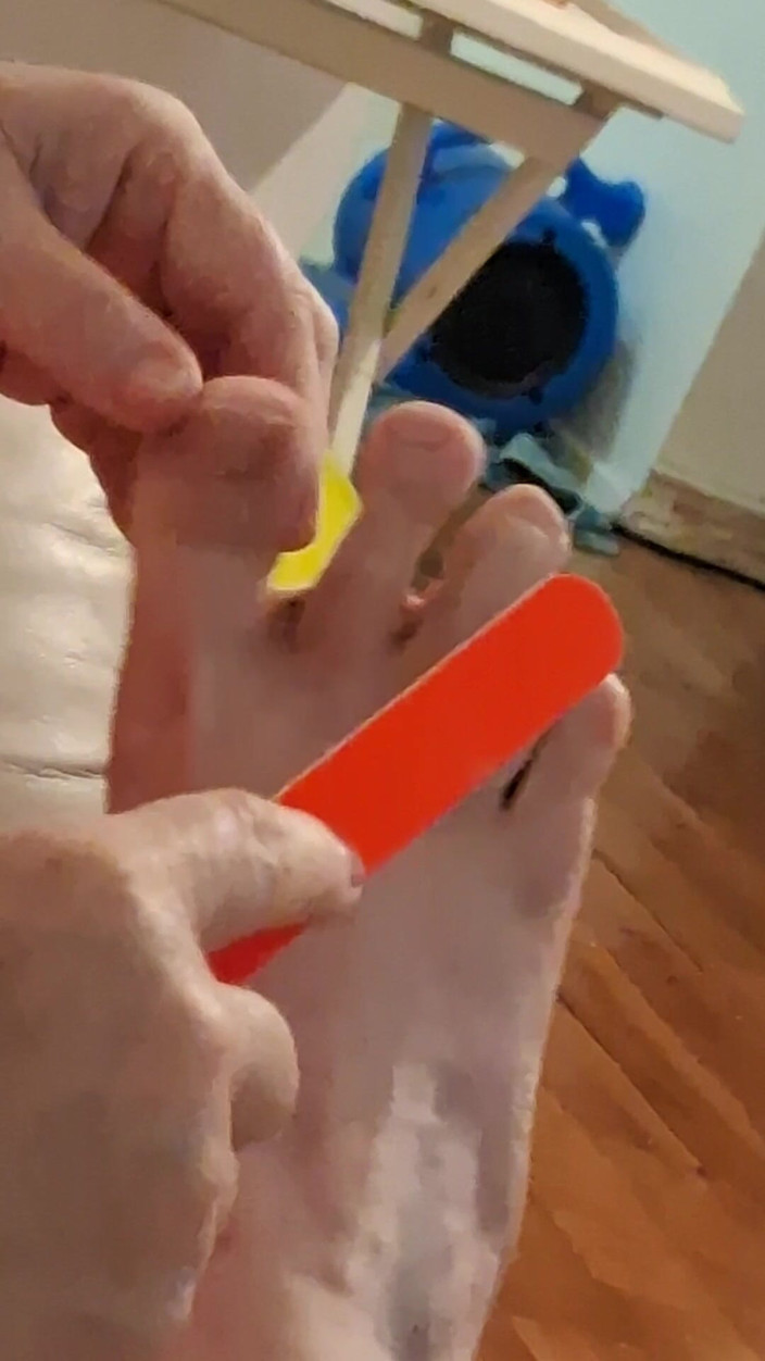 BBW nurse Vicki adventures with friends: Big Beauty Nurse Vicki Cuts Boyfriends Toe Nails He Has...