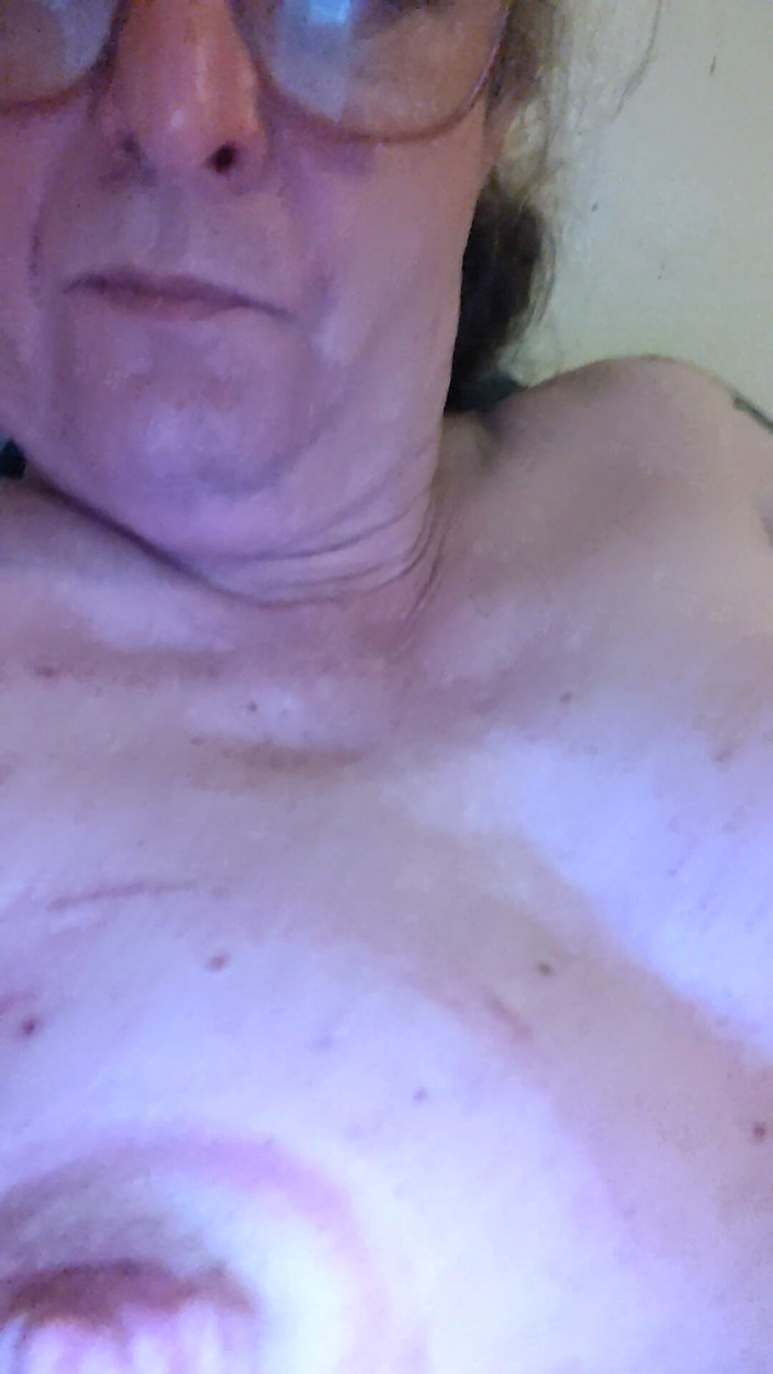 Alexia_mtf: その傷が私を刺激します