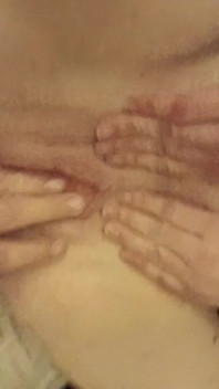 Fisting Tweakers Cunt