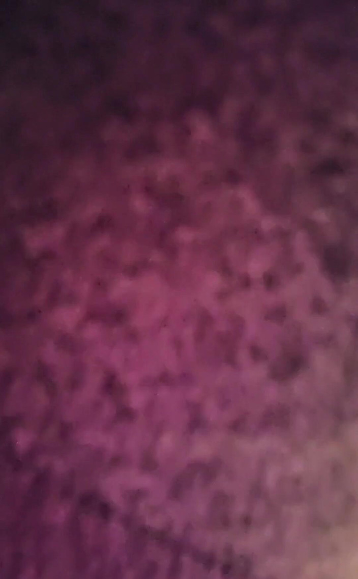 Raven Willow: 10 बबल आंत दर्द बदबूदार पादता है 7