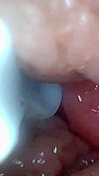 Panduan Visual untuk Rangsangan G-Spot dan Orgasme - Perspektif Endoskopik