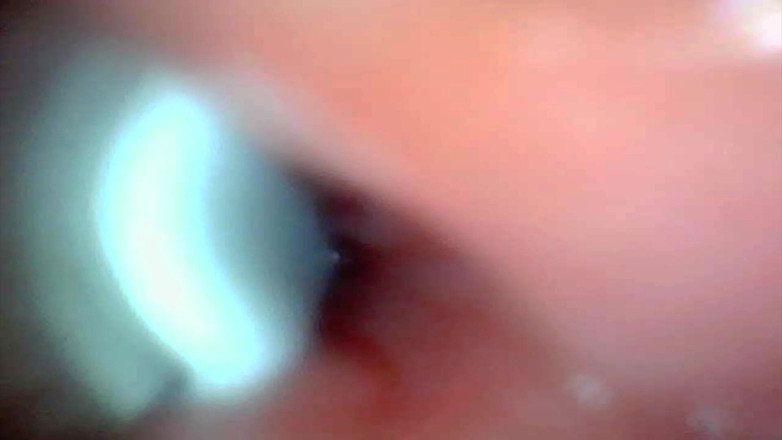 Ladybottox: Endoscope Camera Captures Moment of Male Ejaculation 4K