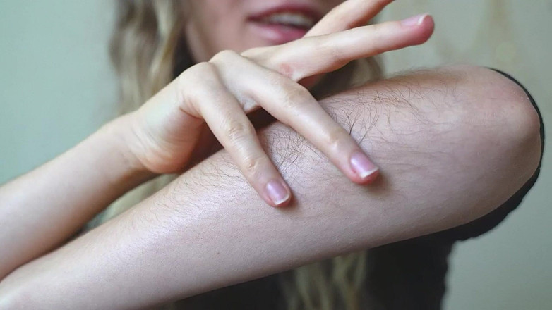 Rarible Diamond: Cạp lông tùy chỉnh