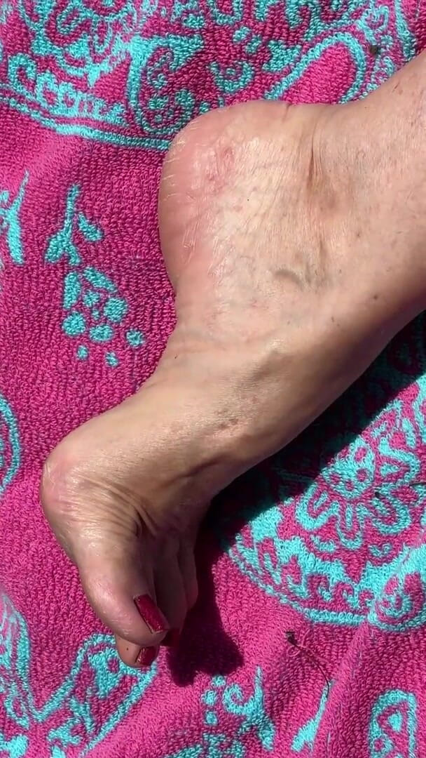 Aunt Ann: Fan Request Granny Naked in Sun Shows Dirty Rough Soles &amp;...