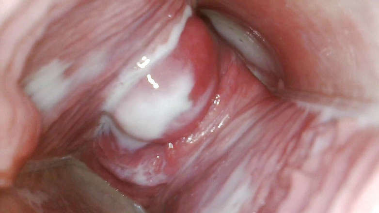 JANA studios: Endoscopio nella mia figa