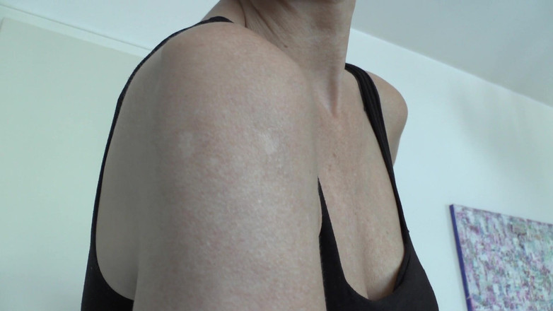 Lady Victoria Valente: 我上臂上的伤痕，Lady Victoria Valente