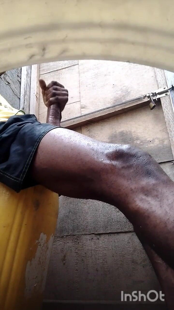 That's_black: BBC Stroke