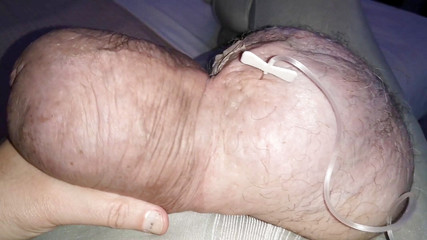 Monster_Meat_: Due litri di glucosio nel mio silicone da 1380cc